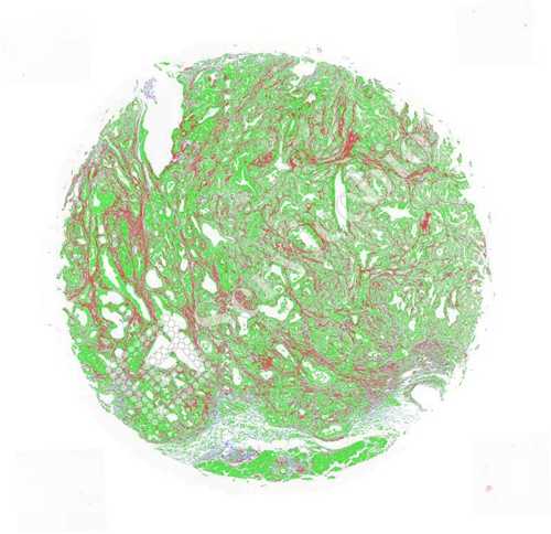 CH2017.5.8 masson 16-A06-m.jpg