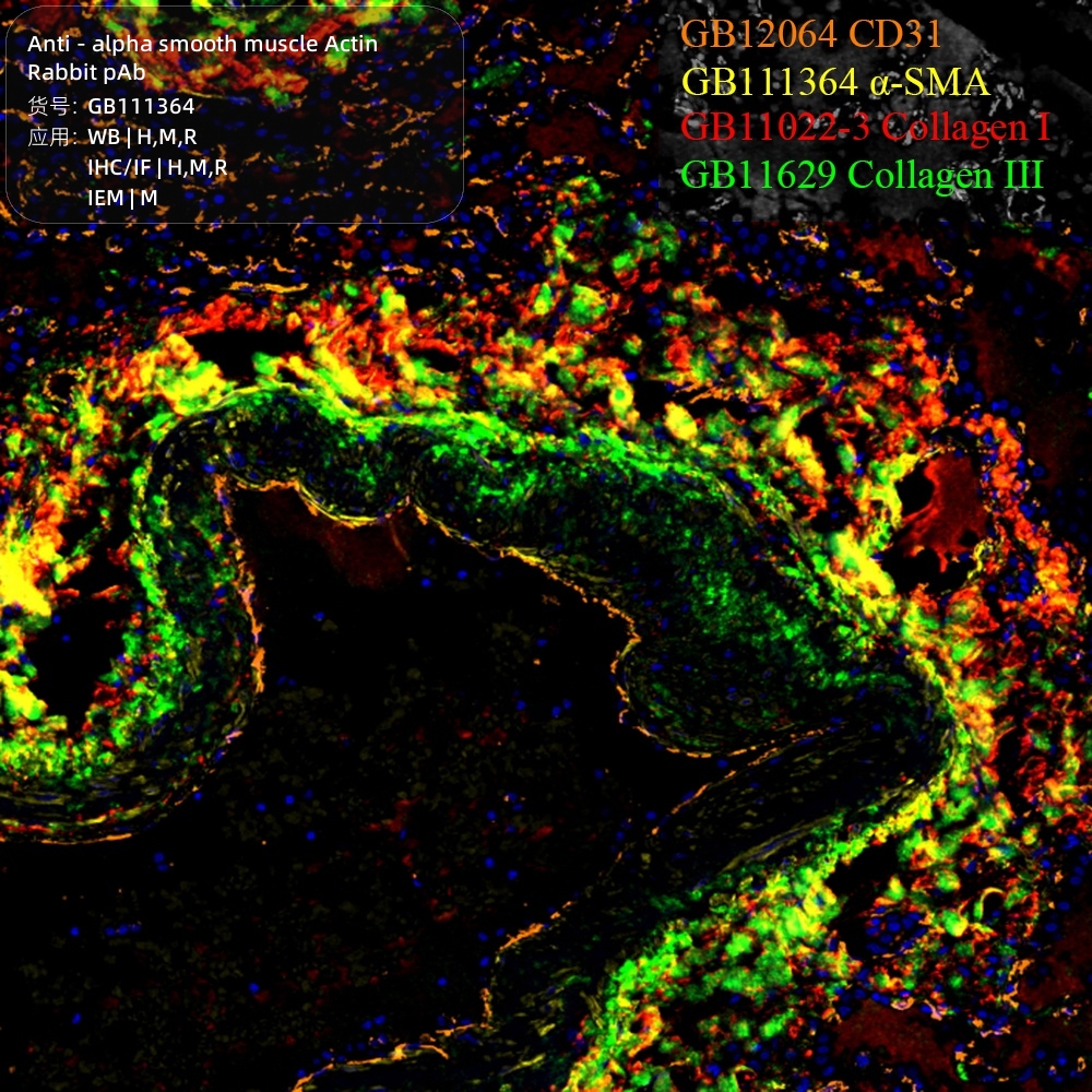 Dapi Rna 赛维尔生物服务|产品_Servicebio_武汉赛维尔生物科技有限公司