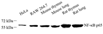 Anti-NF-kB p65 Rabbit pAb