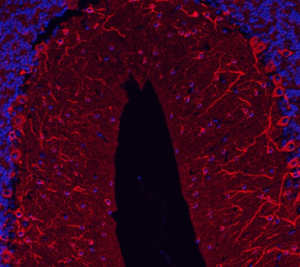 Anti-TUBB3 Mouse mAb