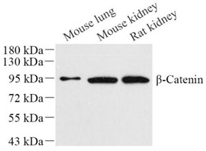 Anti-CTNNB1 Mouse mAb