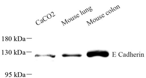 Anti-CDH1 Mouse mAb