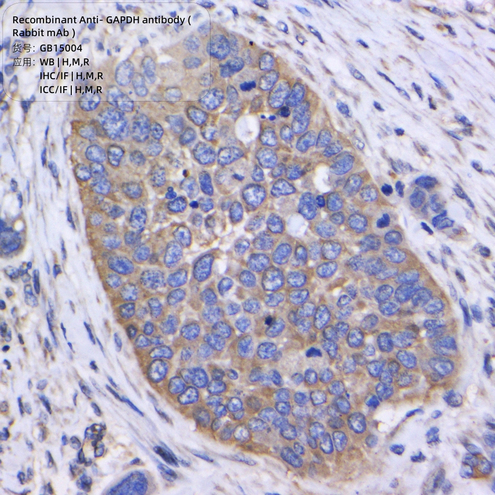 Gamma glutamyl hydrolase (V9) Rabbit mAb