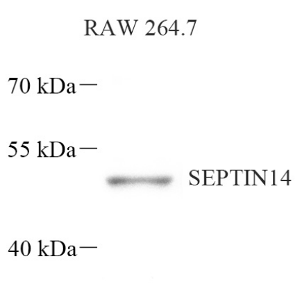 Picture 10(5).png