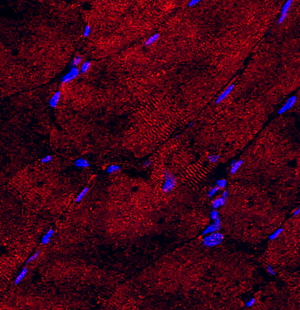 03 GB114494_20220619_NOMO2_11863_1186321062903 H skeletal muscle d700_40.0x_IF.jpg