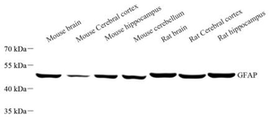 Anti-GFAP Mouse mAb