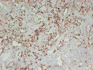 TPO Mouse mAb