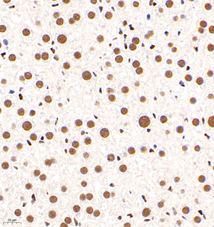 02 GB11296_170601 483_48317040602 GR M liver d3000_40.0x_IHC.jpg