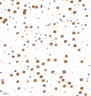 04 GB11296_170601 482_48217040602 GR R liver d1500_40.0x_IHC.jpg