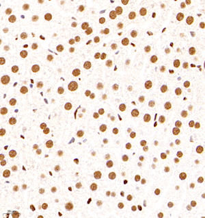 06 GB11296_170601 482_48217040602 GR M liver d1500_40.0x_IHC.jpg