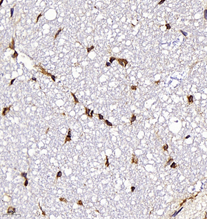 02 GB11346_170701 600_60017060702 Neurotensin R spinal cord d400_40.0x_IHC.jpg