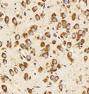 03 GB11346_170701 600_60017060702 Neurotensin R brain d500_40.0x_IHC.jpg