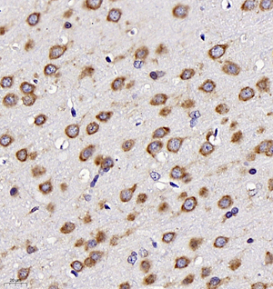 04 GB11346_170701 600_60017060702 Neurotensin R brain d400_40.0x_IHC.jpg