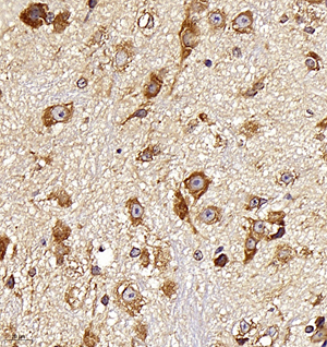 05 GB11346_170701 600_60017060702 Neurotensin M spinal cord d400_40.0x_IHC.jpg