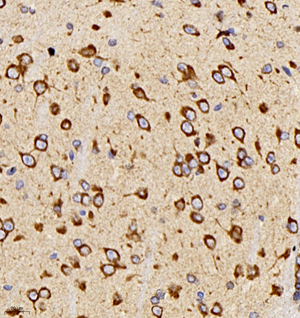 06 GB11346_170701 600_60017060702 Neurotensin M brain d400_40.0x_IHC.jpg