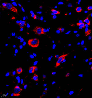 07 GB11346_170701 600_60017060702 Neurotensin R spinal cord d500_40.0x_IF.jpg