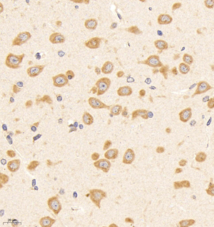 03 GB11700_181101 2186_218618090502 TAK1 R brain d500_40.0x_IHC.jpg