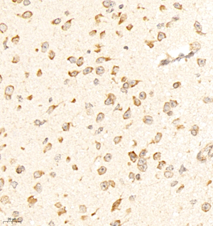 04 GB11700_181101 2186_218618090502 TAK1 M brain d1000_40.0x_IHC.jpg