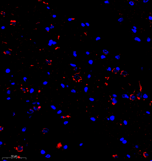 05 GB11986_190301 3358_ ubc13 R spinal cord d500_30.0x_IF.jpg