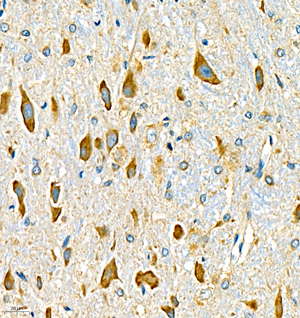 02 GB111004_190501 3410_341019030602 LICAM R epencephalon d2000_40.0x_IHC.jpg