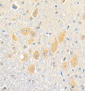 02 GB111055_190501 3570_357019041002 Erc2 R cerebellum d3000_40.0x_IHC.jpg