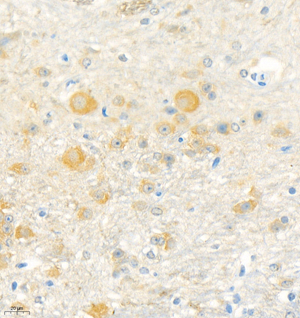 03 GB111055_190501 3570_357019041002 Erc2 M cerebellum d3000_40.0x_IHC.jpg