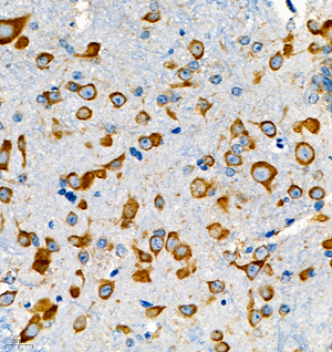 04 GB111368_191001 4571_457119081302 RPL28 M spinal cord d200_40.0x_IHC.jpg