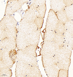 03 GB111939_200601 C053_C05320062402 VDAC1 M skeletal muscle d500_40.0x_IHC.jpg