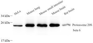 01 GB111951_Proteasome 20S beta 6 Subunit_7063_WB.jpg