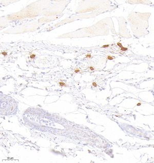 01 GB12109_20220908_Mast cell tryptase_2B7C12_2B7C12 20220813 R skin d1000_20.0x_IHC.jpg