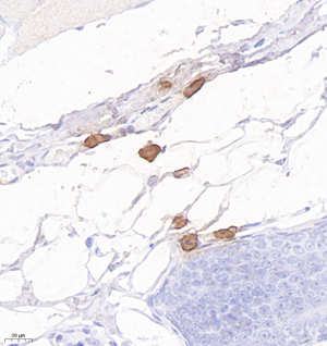 04 GB12109_20220908_Mast cell tryptase_2B7C12_2B7C12 20220813 R skin d1000_IHC_40.0x.jpg