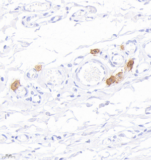 01 GB12110_20220908_Mast cell tryptase_3B7A1_3B7A1 20220813 R skin d1000_40.0x_IHC.jpg