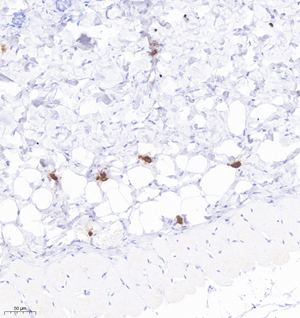 05 GB12110_20220908_Mast cell tryptase_3B7A1_3B7A1 20220813  M skin d1000_20.0x_IHC.jpg