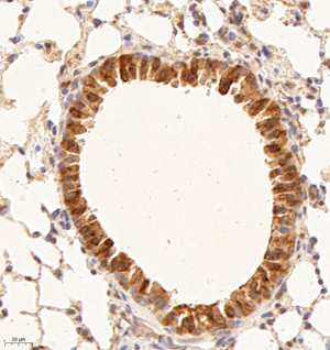 02 GB114946_20220908_RXFP1_12949_1294921101902 M lung d1000_IHC_40.0x.jpg