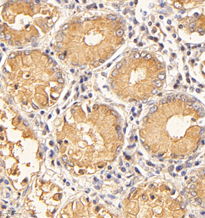 03 GB114946_20220908_RXFP1_12949_1294921101902 H gastric d1000_IHC_40.0x.jpg