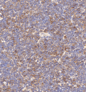 04 GB114950_20220908_SDCCAG8_12977_1297720102602 M thymus gland d1000_IHC_40.0x.jpg