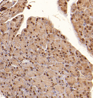 02 GB114960_20221010_RBM6_13068_1306822030202 M pancreas d800_30.0x_IHC.jpg