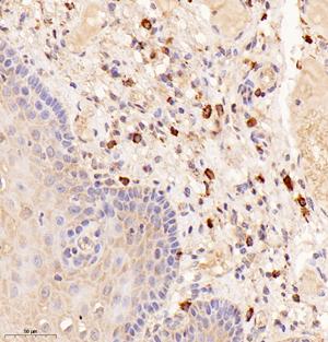 02 GB114968_20221010_CarboxypeptidaseA3_13097_1309722030202 H esophagus d800_30.0x_IHC.jpg