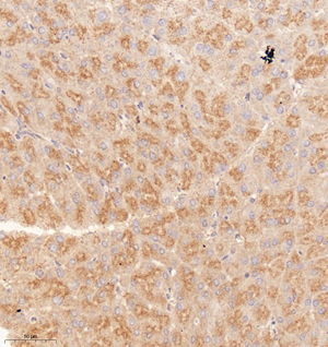 01 GB114979_20221010_SH3GL3_13117_1311722030202 M pancreas d800_30.0x_IHC.jpg