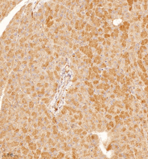 02 GB114980_20221010_DECR1_13120_1312022030202 M liver d800_IHC_20.0x.jpg