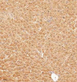 01 GB114986_20221010_AGPAT2_13141_1314122030202 M liver d800_20.0x_IHC.jpg