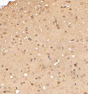 03 GB114987_20221010_MED22_13146_1314622030202 R brain d800_30.0x_IHC.jpg