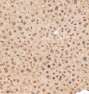 04 GB114987_20221010_MED22_13146_1314622030202 M liver d800_30.0x_IHC.jpg