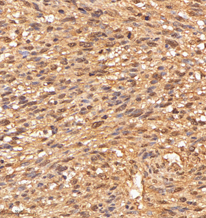 05 GB114987_20221010_MED22_13146_1314622030202 H smooth muscle d800_30.0x_IHC.jpg