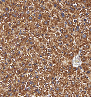 04 GB114992_20221010_ARMC10_13170_1317022032202 R liver d800_30.0x_IHC.jpg