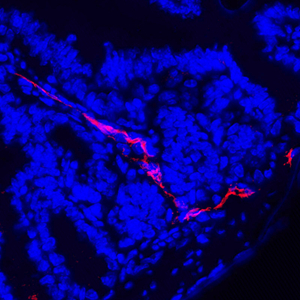 01 GB11127_LYVE-1_20220517 M duodenum d2000_40.0x_IF.jpg