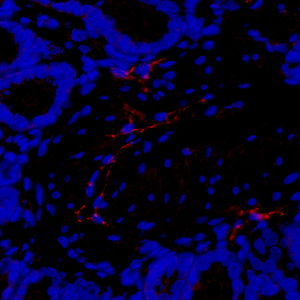 02 GB11127_LYVE-1_20220517 R colon d1000_40.0x_IF.jpg