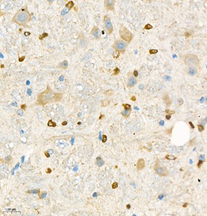 01 GB11347_NOX4_20220505 M cerebellum d2000_40.0x_IHC.jpg