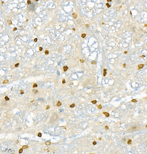 02 GB11347_NOX4_20220505 R cerebellum d2000_40.0x_IHC.jpg