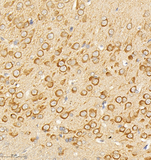 04  GB114563_20220908_DPYSL5_12573_1257321081702 R brain d800_IHC_30.0x.jpg